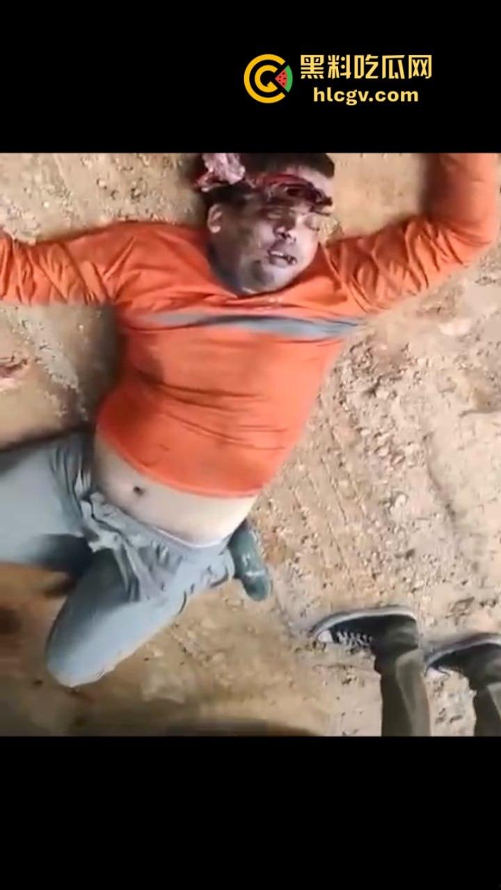 太惨了！因操作不当 巴西倒霉男子脑袋被挤爆  血腥现场视频曝光 胆小慎入-2